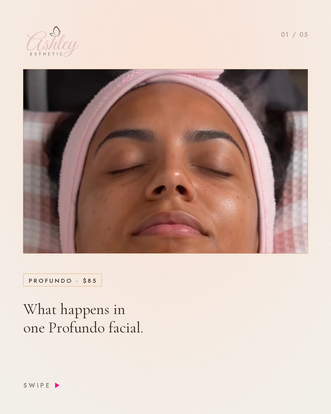 1 · What happens in one Profundo facial