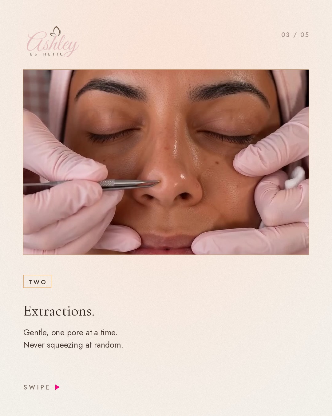 3 · Extractions